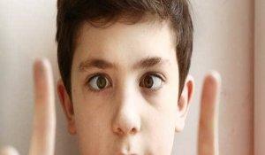 افضل دكتور علاج الحول في المحلة